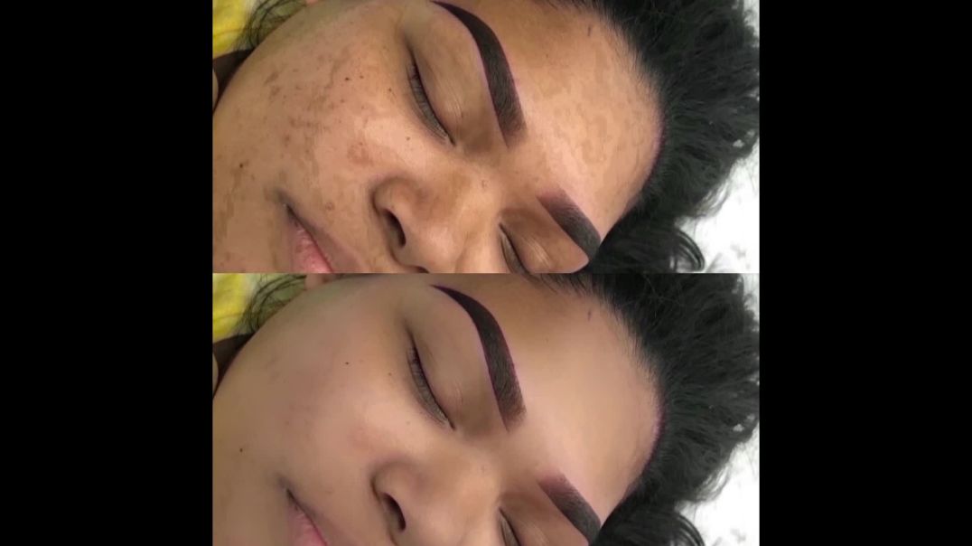 CEJAS EN POLVO DEGRADADAS-EDICIÓN FOTOGRÁFICA-Cap.66